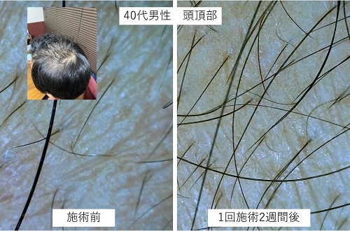 ダウンロード (3)