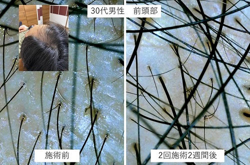 ダウンロード (4)