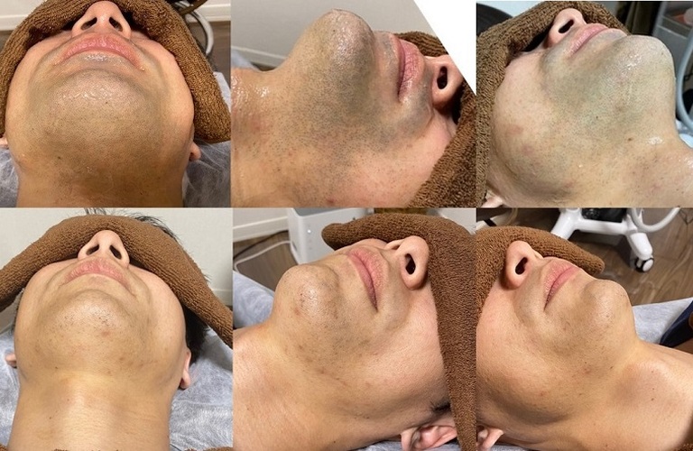 お客様のビフォーアフター