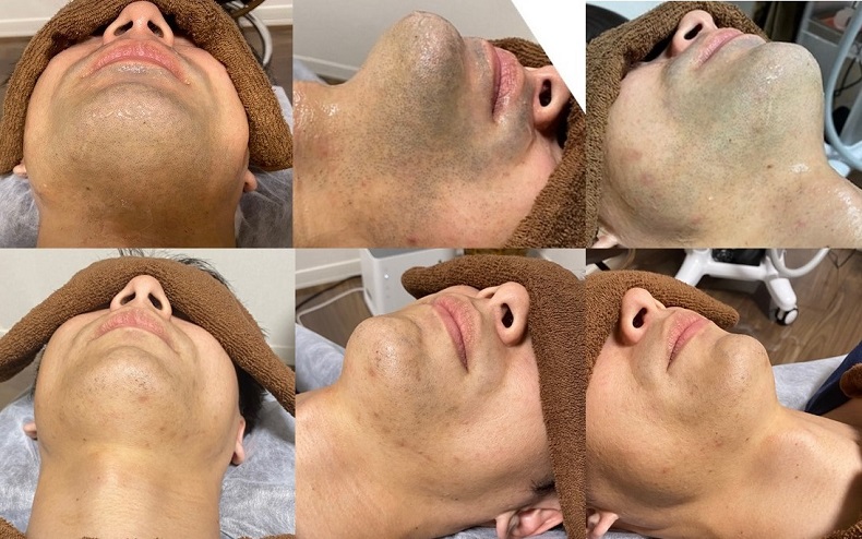 上村様