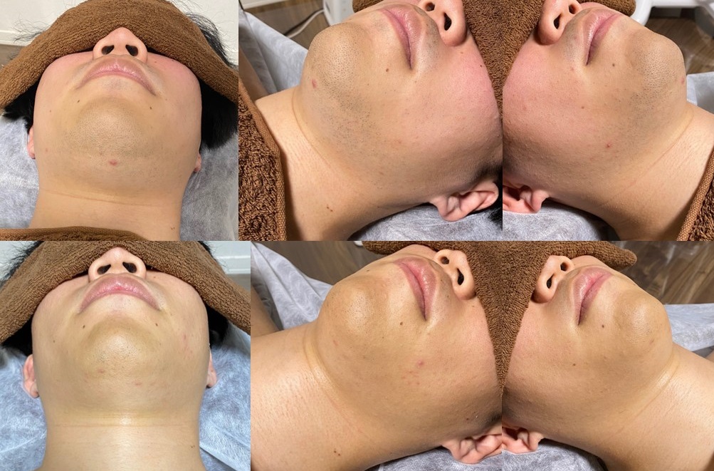 小松様１２回