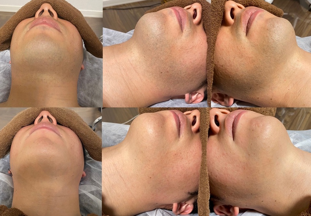 高木様１８回