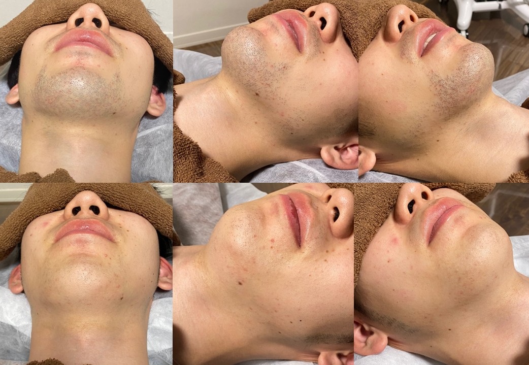 久保田様１８回